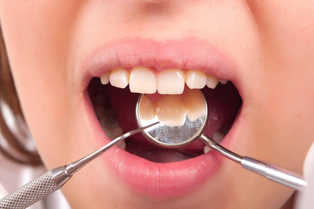 teeth-fillings.jpg